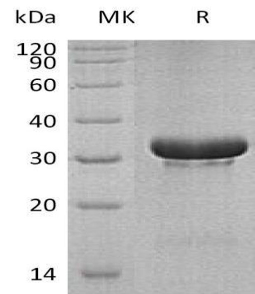 Human TRIM5/RNF88 Recombinant Protein (RPES1409)