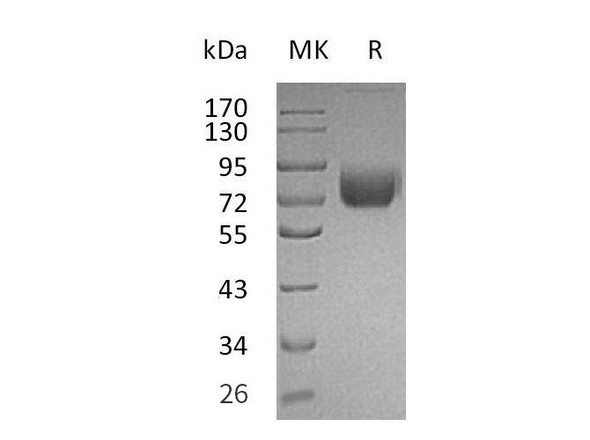 Mouse IFNGR1 Recombinant Protein (RPES1411)