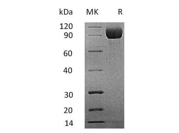 Mouse IL13RA1 Recombinant Protein (RPES1416)