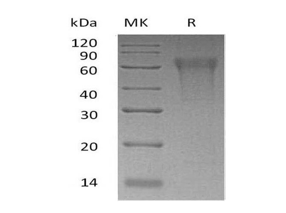 Human CLM-9/TREM4 Recombinant Protein (RPES1453)