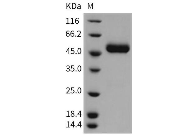 Rat CNTFR/CNTFR-alpha Recombinant Protein (RPES1461)