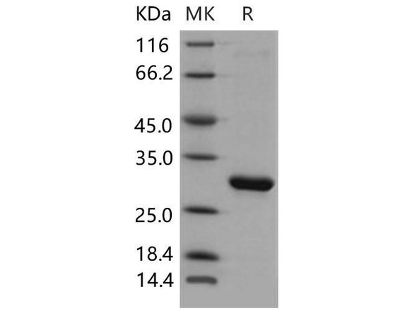 Mouse HPGD/15-PGDH Recombinant Protein (RPES1462)