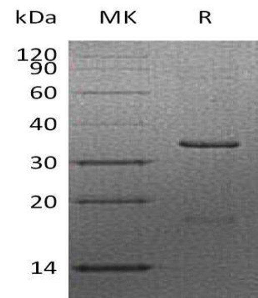 Human Cyclin-D2/CCND2 Recombinant Protein (RPES1465)