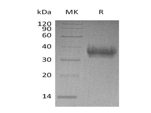Human EPCR Recombinant Protein (RPES1473)