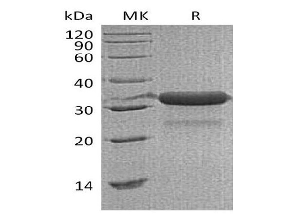 Mouse IGFBP-7/IGFBP7 Recombinant Protein (RPES1475)