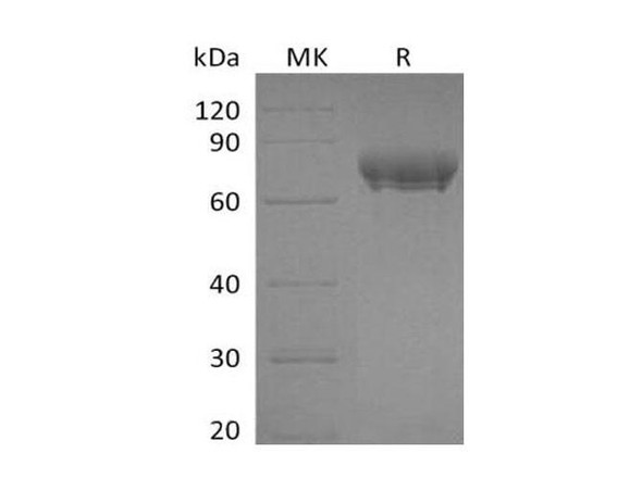 Human PD-L1/B7-H1/CD274 Recombinant Protein (RPES1505)