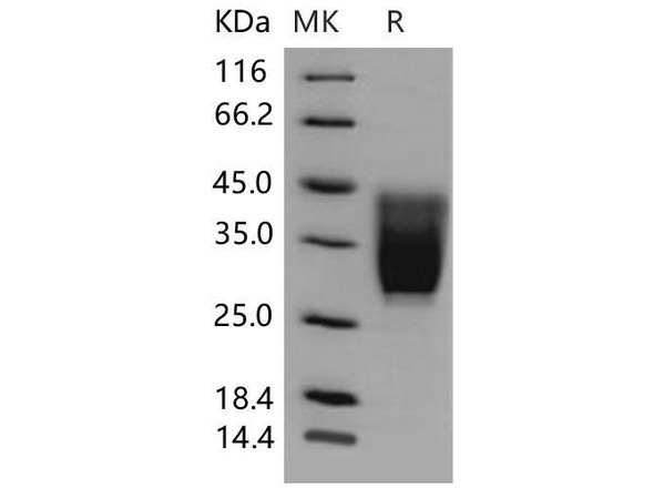 Mouse CD99L2 Recombinant Protein (RPES1520)