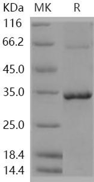 Human NMNAT1/NMNAT Recombinant Protein (RPES1536)