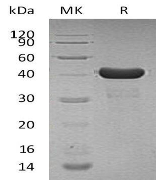 Human Cyclophilin D/PPID Recombinant Protein (RPES1544)