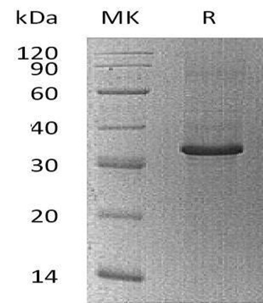 Human Cyclophilin C/PPIC Recombinant Protein (RPES1562)