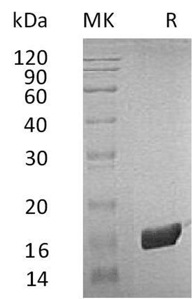 Human FKBP2 Recombinant Protein (RPES1564)