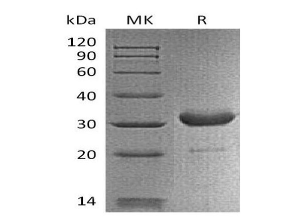 Mouse IgG2b-Fc Recombinant Protein (RPES1572)