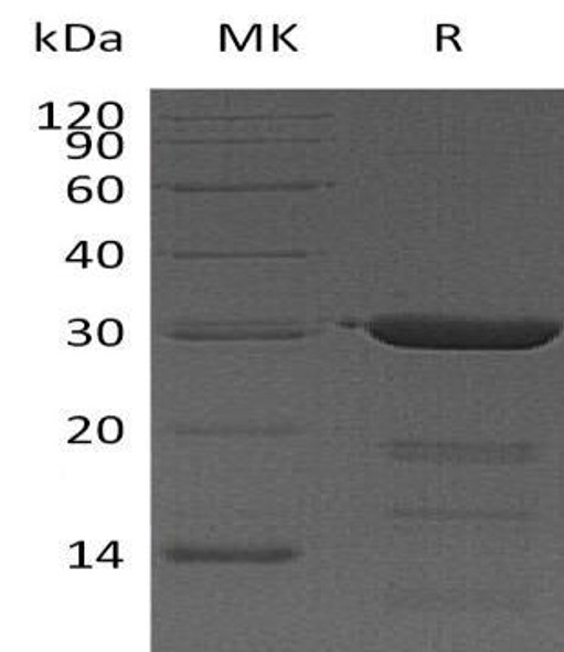 Human FKBP3/FKBP25 Recombinant Protein (RPES1583)