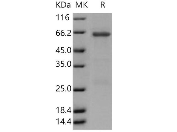 Human TRIB3/TRB3 Recombinant Protein (RPES1592)