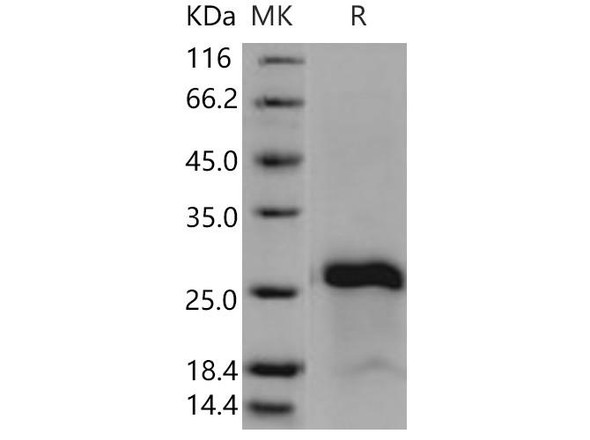 IGJ/Immunoglobulin J Chain Recombinant Protein (RPES1593)