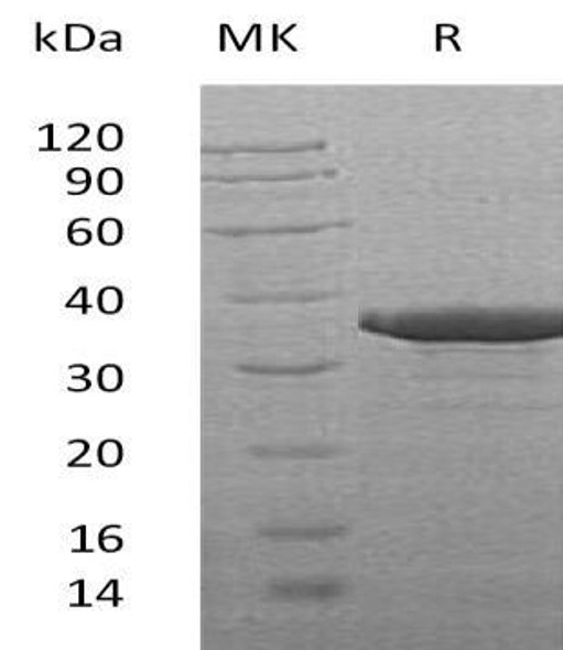 Human SULT2B1 Recombinant Protein (RPES1594)