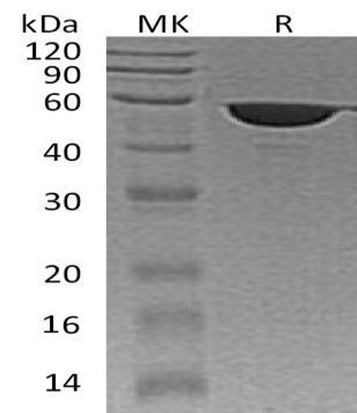 Human FKBP4 Recombinant Protein (RPES1603)