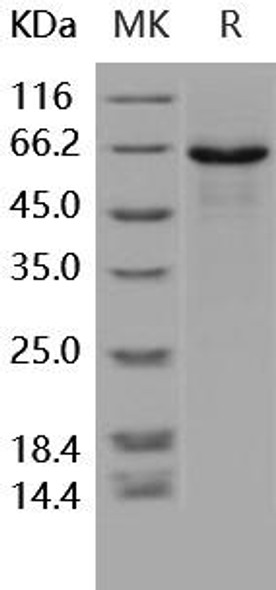 Human PCSK1/NEC1 Recombinant Protein (RPES1635)