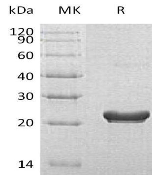 Human RPS7 Recombinant Protein (RPES1660)