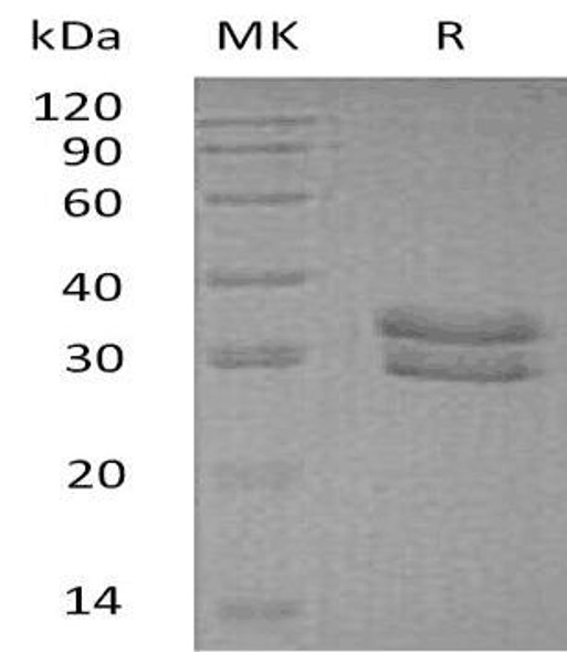 Human ITM2B Recombinant Protein (RPES1662)