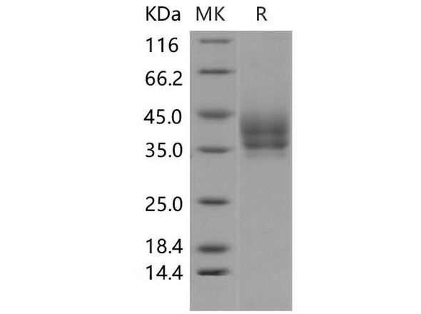 Mouse B7-DC/PD-L2/CD273 Recombinant Protein (RPES1665)