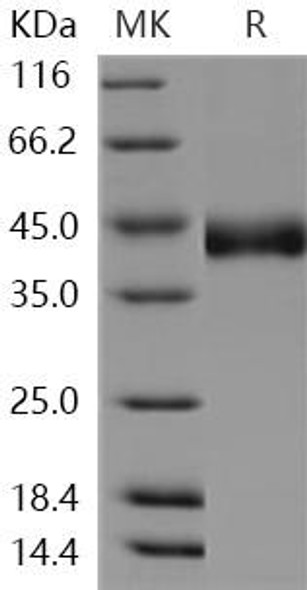 Human CHST11/C4ST Recombinant Protein (RPES1674)