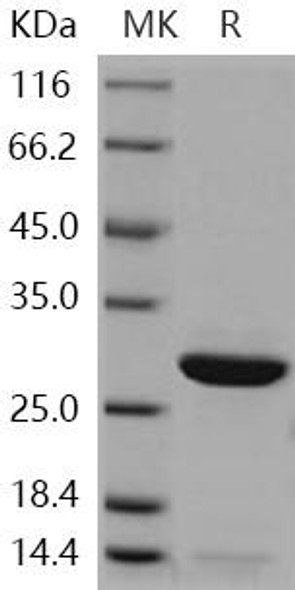 Human Peroxiredoxin 6/PRDX6 Recombinant Protein (RPES1679)