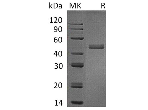 Human IL17B/IL7B Recombinant Protein (RPES1691)