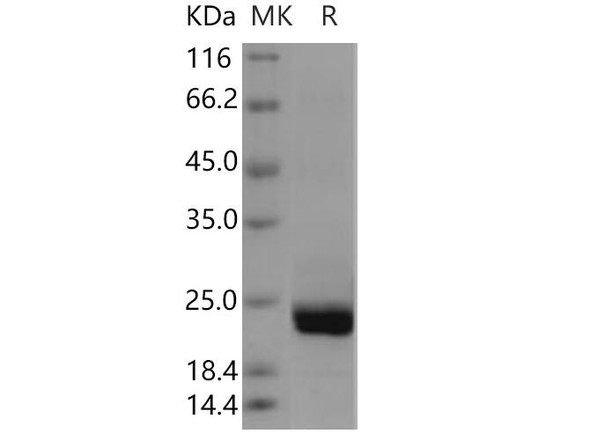 Human PTPMT1 Recombinant Protein (RPES1713)