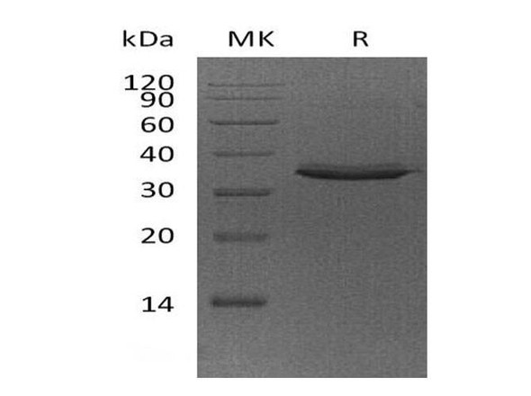 Human FN14/TWEAKR Recombinant Protein (RPES1724)