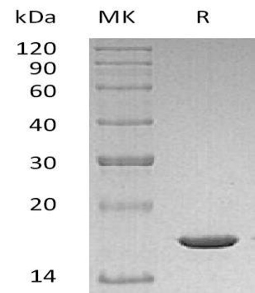 Mouse IL beta/IL1B Recombinant Protein (RPES1726)