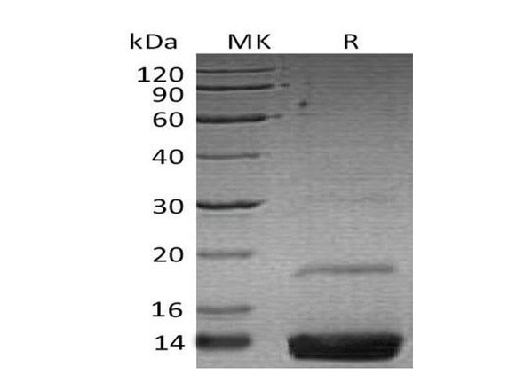 Human Resistin Recombinant Protein (RPES1730)