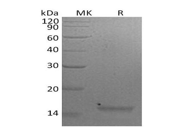 Mouse Interleukin-21/IL-21 Recombinant Protein (RPES1745)