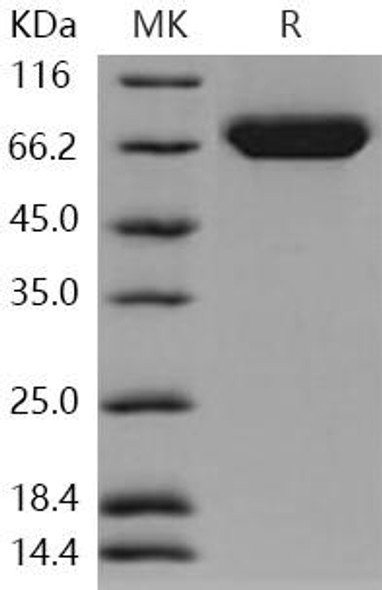 Human B7-H3/CD276 Recombinant Protein (RPES1759)
