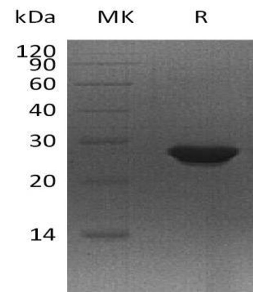 Human MTHFS Recombinant Protein (RPES1800)