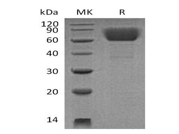 Mouse CD39/ENTPD1 Recombinant Protein (RPES1812)