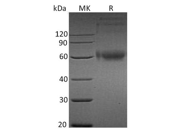 Human ILRAcP/IL1R3 Recombinant Protein (RPES1849)