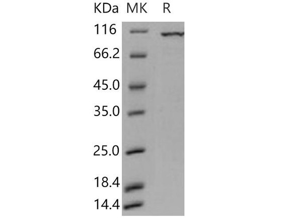 Human PKC iota/PRKCI Recombinant Protein (RPES1871)
