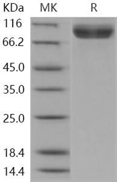 Human NAALADL1 Recombinant Protein (RPES1876)