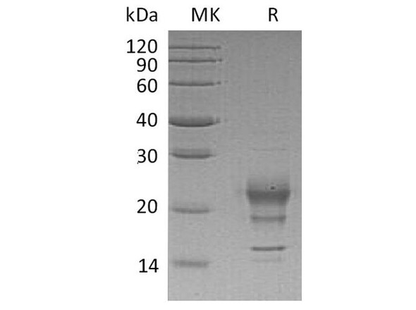 Human Interferon gamma/IFNG Recombinant Protein (RPES1879)