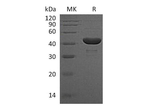 Human PGK1/PGKA Recombinant Protein (RPES1880)