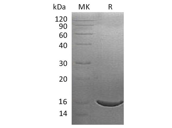 Human ISG15/G1P2 Recombinant Protein (RPES1887)