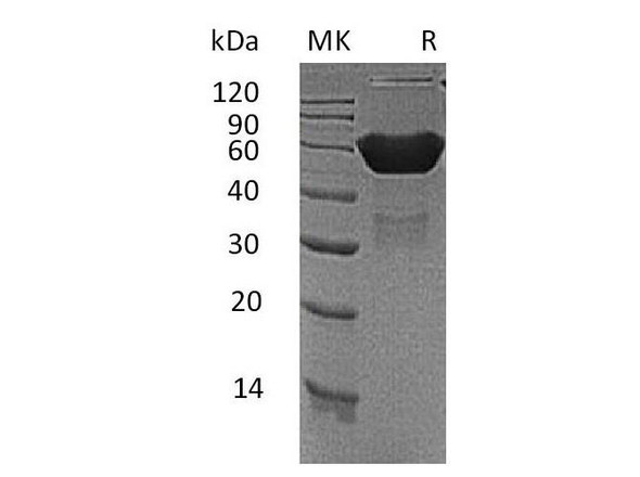 Mouse CXADR/CAR Recombinant Protein (RPES1888)