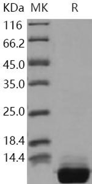 Human S100A10 Recombinant Protein (RPES1896)