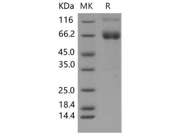 Mouse IFNGR1/CD119 Recombinant Protein (RPES1923)