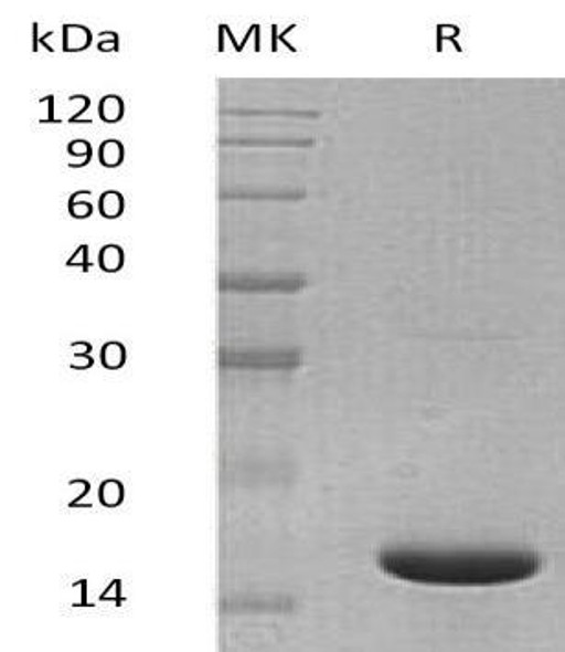 Mouse IL1F6/IL36A Recombinant Protein (RPES1924)