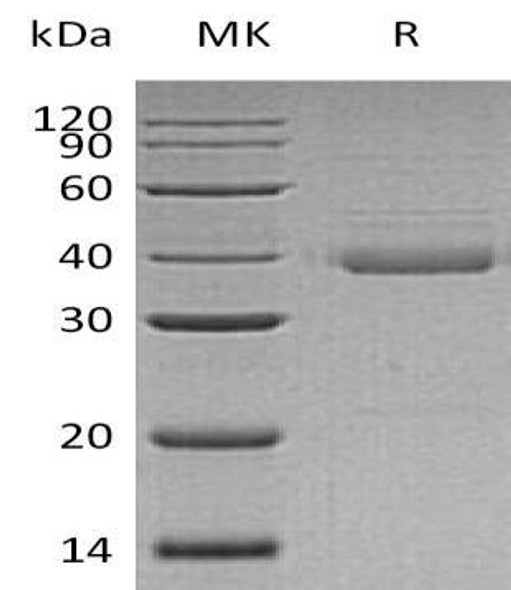 Human UQCRH Recombinant Protein (RPES1939)