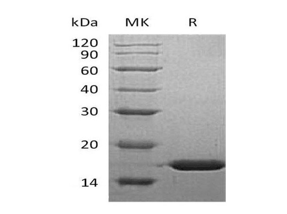 Human FABP5 Recombinant Protein (RPES1967)