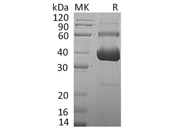 Human Activin RIIA/ACVR2A Recombinant Protein (RPES1977)
