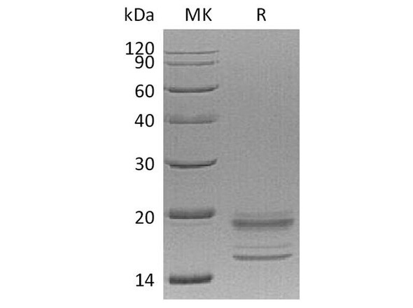 Human IL7A&IL7F Heterodimer Recombinant Protein (RPES1979)